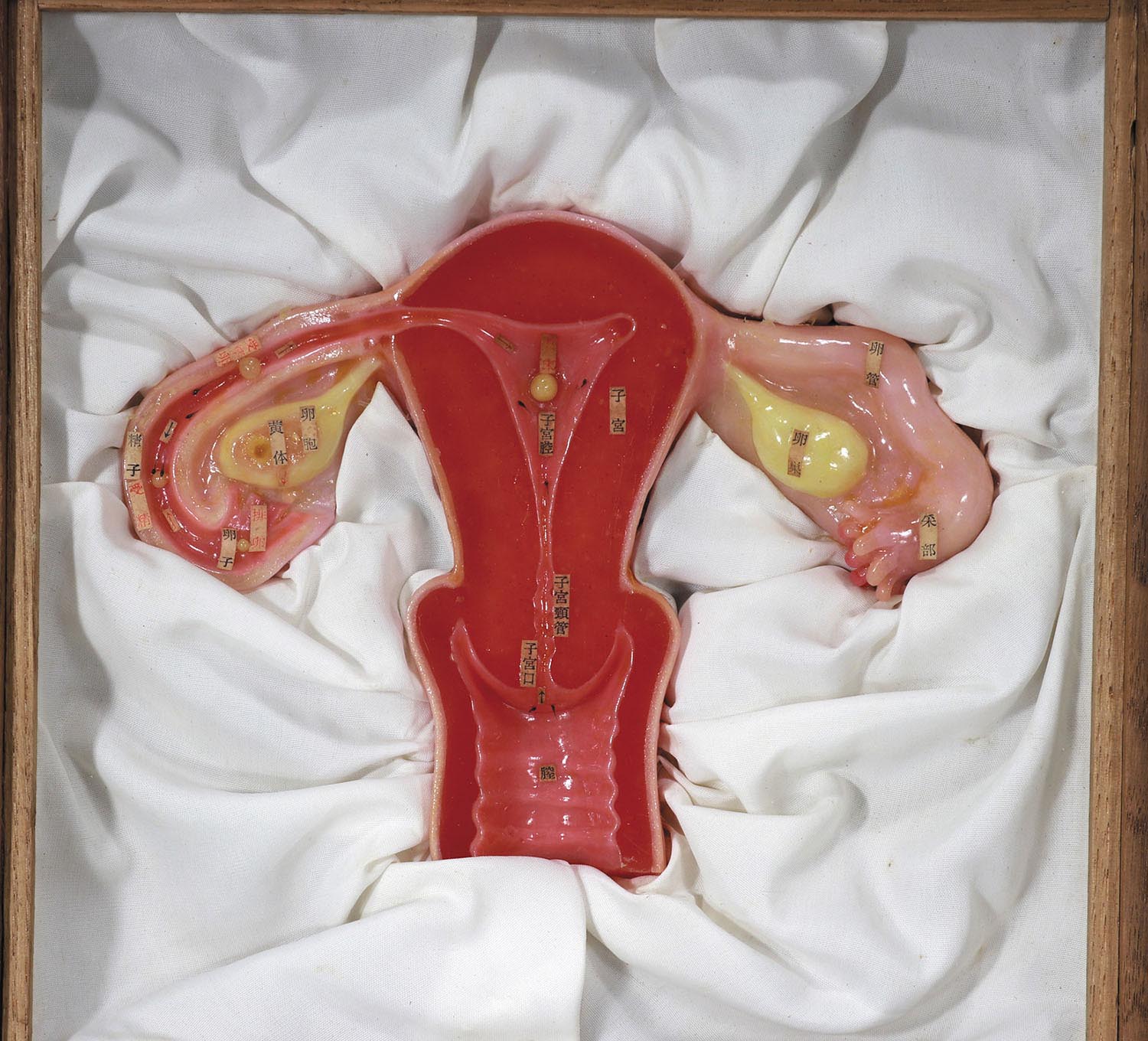 Uterus Model